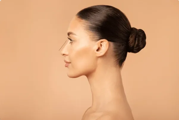 Rinoplastia y Bichectomía en Málaga: Arte y Precisión en la Cirugía Facial